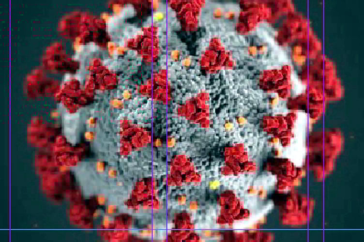 Coronavirus.