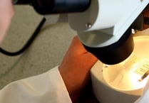Fewer people in Devon completing cervical screenings