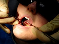 Dozens of hospital admissions in Torridge to remove children's rotten teeth