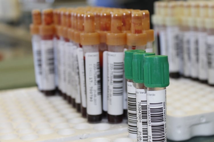 Blood test containers