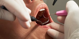 Extra 24,000 dentist appointments promised for Devon 