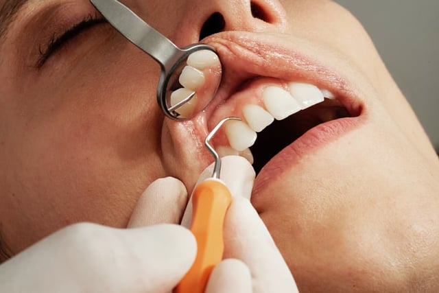 Devon's dental van plan halted
